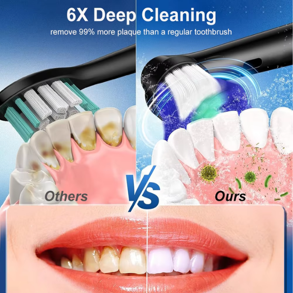 Rotating Electric Toothbrush 5 Modes 4 Brush Heads Smart Timer USB Rechargeable